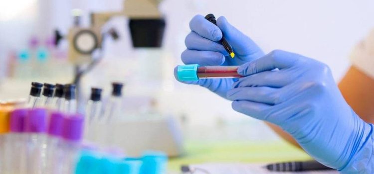 Descubren un análisis de sangre que detecta cáncer de colon con más del 80% de efectividad