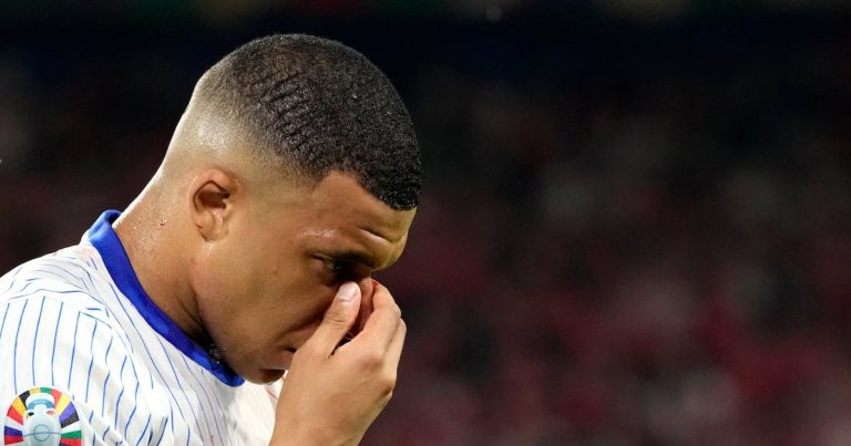 Mbappé jugará el resto de la Euro con máscara