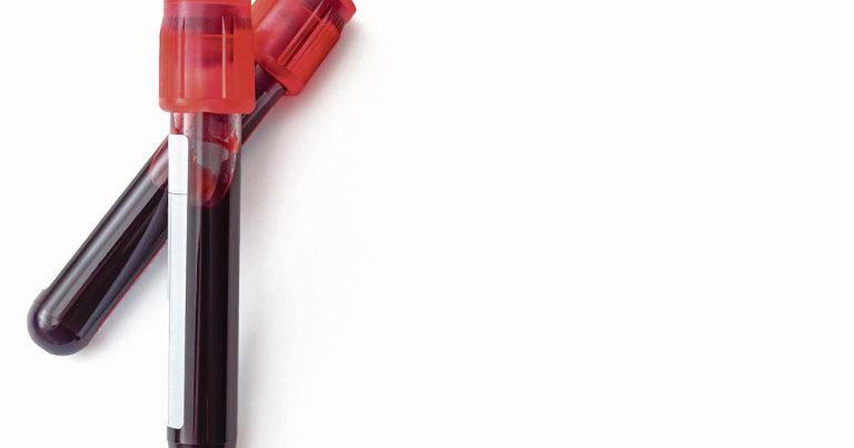 Sombra de prejuicios aún ronda las donaciones de sangre