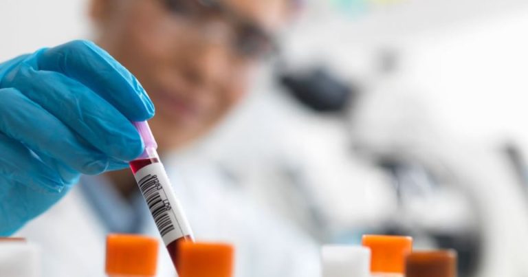 Análisis de sangre podría predecir el Parkinson siete años antes de cualquier síntoma