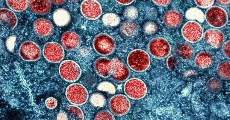 Suecia reporta primer caso de forma más infecciosa de viruela símica